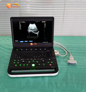 SUN-800C Woman Pregnancy Ultrasound Scanner <strong>Ecography</strong> Laptop Digital USG Diagnostic PW BW Ultrasound Machine - Product Image 5