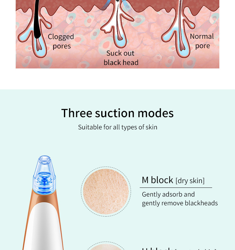 Recuperador de puntos negros para la piel, instrumento de belleza para el hogar.