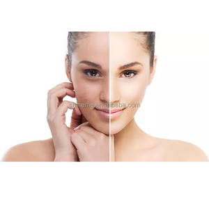 Solución Exfoliante OEM ODM, Limpieza Profunda de la Piel, Exfoliación Enzimática y con AHAS, Mascarilla Exfoliante Bioactiva Enzimática Instantánea - Product Image 2