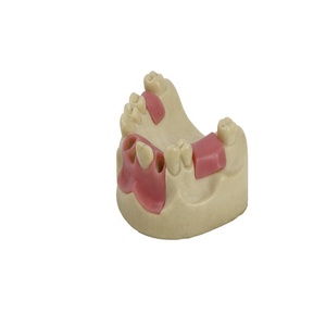 การสอนเข่า implant Model - Product Image 1