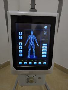 جهاز أشعة سينية طبي محمول من الجيل الجديد لعام <span class=keywords><strong>2025</strong></span> - Product Image 5