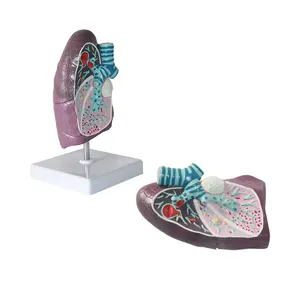 Pathological Lung Anatomical Model For Medical Teaching Lung Disease Model