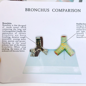 Modelo Comparativo de Tráquea Humana Saludable y Tráquea Dañada por el Tabaco - Product Image 4