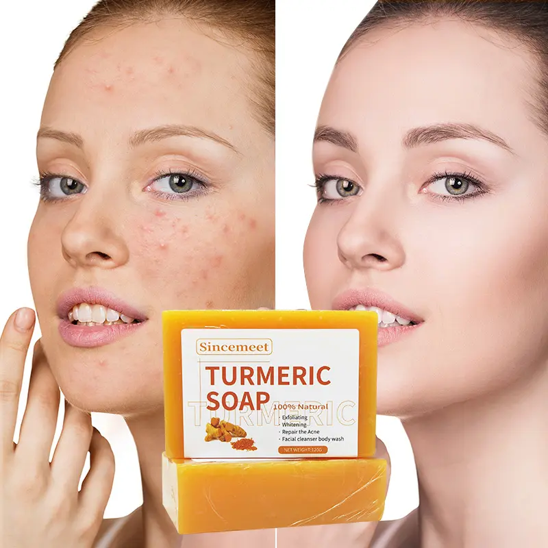 Oem Organische Kurkuma Zeep Gezicht Skin Whitening Savon Anti Acne Handgemaakte Tumeric Bad Zeep Bar