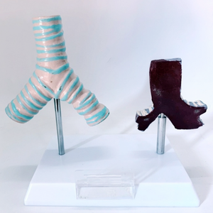 Modelo Comparativo de Tráquea Humana Saludable y Tráquea Dañada por el Tabaco - Product Image 2