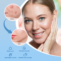 Patchs Hydrocolloïdes Anti-Acné à l'Huile d'Arbre à Thé, Autocollants Naturels pour Boutons, Traitement Localisé des Imperfections pour le Visage, Vente en Gros OEM Personnalisée