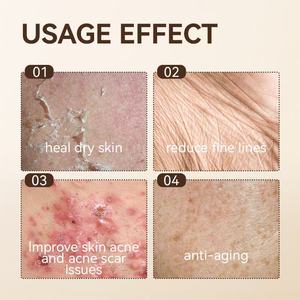 Oem nhà máy bán hàng trực tiếp Centella Tea Tree Set tì vết chăm sóc Combo cho da kết hợp trẻ hóa làm trắng khuôn mặt thói quen - Product Image 3