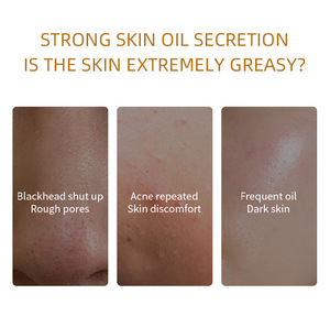 Sifuli rubioaroma đất sét hữu cơ mặt nạ Kit nhãn hiệu riêng nghệ màu xanh lá cây trà hồng tăng mặt bùn đất sét Mặt nạ Mặt nạ cho da mụn - Product Image 4