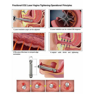 Machine <span class=keywords><strong>laser</strong></span> fractionnelle Co2 d'équipement de dermatologie de <span class=keywords><strong>prix</strong></span> usine pour le resserrement de la peau d'enlèvement de cicatrice de visage - Product Image 4
