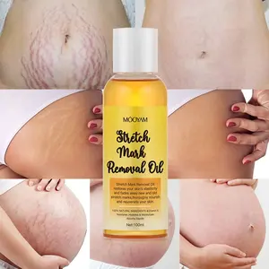 100% natürlicher Ursprung Dehnung streifen Präventions öl Hautpflege Stretch Mark Massage öl - Product Image 1