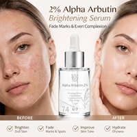 Özel Marka %2 Alfa Arbutin Aydınlatıcı Serum Koyu Lekeleri Giderici Niacinamide Ginseng Pirinç Beyazlatıcı Yüz Serumu OEM