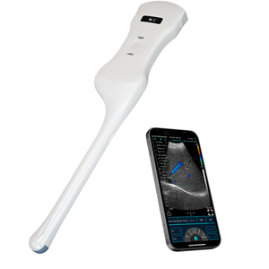 <span class=keywords><strong>Probe</strong></span> Doppler Warna Obstetri dan Ginekologi Portabel Nirkabel Konted Convex+Transvaginal - Product Image 5