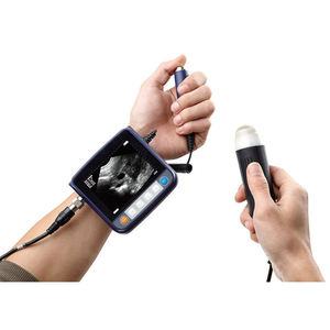 Échographie vétérinaire Vet Sunbright utilisée pour la grossesse des animaux Scanner à ultrasons vétérinaire portable pour poignet - Product Image 4