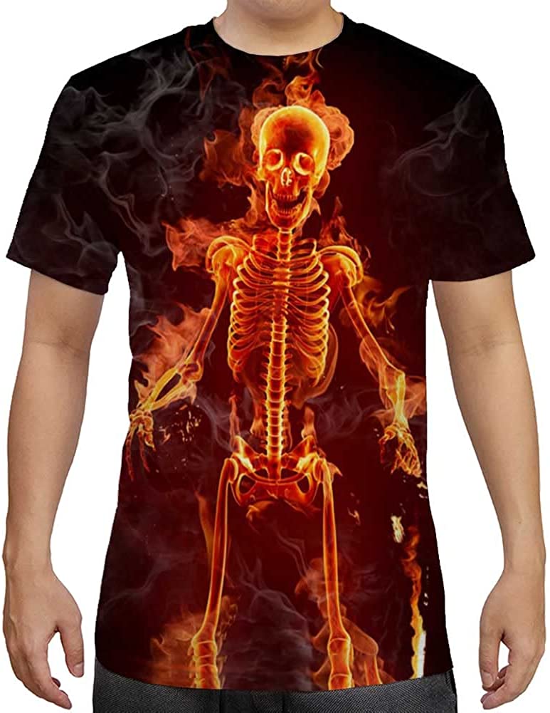 Burning Skull