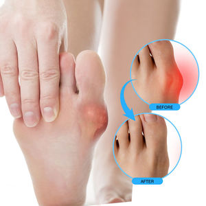 Crème pour les douleurs articulaires à base d'ingrédients naturels, résultats rapides, soin des pieds, crème pour les douleurs aux orteils, soin des pieds, crème pour les bunions - Product Image 6