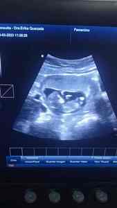 Máquina Doppler de Color 3D para clínica de mascotas, equipo de imágenes de diagnóstico médico, escáner de ultrasonido 3D portátil para clínica de mascotas, dispositivo de diagnóstico por imagen - Product Image 2