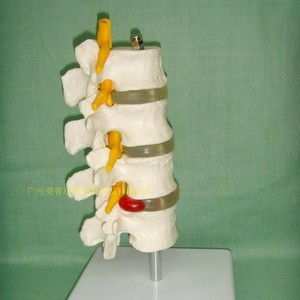 Vertèbres lombaires humaines en quatre segments ; modèle de vertèbres lombaires ; colonne vertébrale ; modèle de colonne vertébrale ; modèle de disque intervertébral lombaire. - Product Image 2