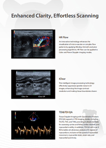 Appareil d'échographie Doppler couleur vétérinaire Mindray Vetus E3, système d'imagerie diagnostique pour animaux, système d'échographie pour cliniques vétérinaires - Product Image 6