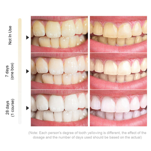 <span class=keywords><strong>Gel</strong></span> Blanqueador Dental Profesional Sin Peróxido, Económico y Fuerte, <span class=keywords><strong>Gel</strong></span> Blanqueador Dental Híbrido Dual Desensibilizante - Product Image 4