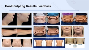 <strong>CoolSculpting</strong> II Multi-Tech Body Contouring System <strong>Home</strong> <strong>Use</strong> Standing ABS LED with Fat Freezing &amp; Cryolipolysis Technology - Product Image 5
