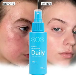 FATAZEN OEM Spray Facial Apaisant et Hydratant à l'Acide Hypochloreux pour Peaux Sensibles, Soulagement Eczéma et Rosacée, Purifiant et Équilibrant - Product Image 1