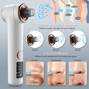 Dispositivo Portátil Recargable a Prueba de Agua para Limpieza de Puntos Negros, Eliminación de Puntos Negros en la Nariz y el Rostro - Product Image 3