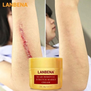 marcas eliminación crema embarazo cicatriz tratamiento de reparación Crema de Cara de piel suave cuerpo Dropshipping Exclusivo - Product Image 3