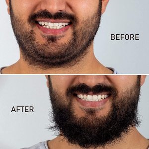Aceite para <span class=keywords><strong>Barba</strong></span> 100% Natural de Marca Privada, Bálsamo para Peinar la <span class=keywords><strong>Barba</strong></span>, Cera para el Cuidado de la <span class=keywords><strong>Barba</strong></span>, <span class=keywords><strong>Kit</strong></span> de Crecimiento de <span class=keywords><strong>Barba</strong></span> - Product Image 4