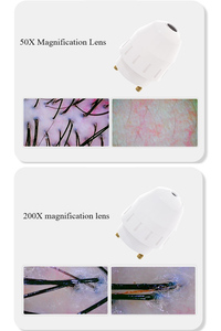 AU-958A Big Screen Clear Beauty Skin Analysis Camera Photo Analysing Machines Facial Hair Scalp Scanner - Product Image 4