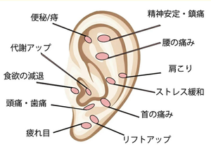Autocollant de <span class=keywords><strong>point</strong></span> de thérapie porcelaine/boule en céramique graines <span class=keywords><strong>d</strong></span>'<span class=keywords><strong>oreille</strong></span> anti-allergie aux métaux avec ruban adhésif transparent sur feuille de papier écologique - Product Image 6