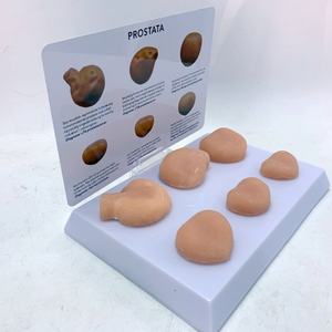 Modelo Anatómico de Tumor Prostático Humano para Ciencias Médicas, Modelo de Anatomía Humana - Product Image 3