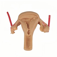 Modelo de Silicona 3D de Útero para Sutura y Disección Laparoscópica e Histeroscópica en Ginecología y Obstetricia