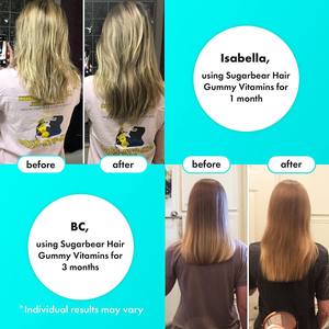 Vitamines pour cheveux OEM Gummy 5100mcg Biotine Acide folique Complément alimentaire 60 Gummies à la pectine de fruits Soins capillaires pour femmes - Product Image 5