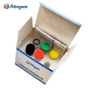 Plasmodium Falciparum/Intermittent/Oviparum/Triple Day <strong>Malaria</strong> Nucleic Acid Detection Kit(50 <strong>Tests</strong>/Kit)405 - Product Image 4