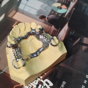 Imprimante 3D dentaire personnalisée pour la dentisterie, impression 3D rapide SLM, fabrication de prototypes, support - Product Image 5