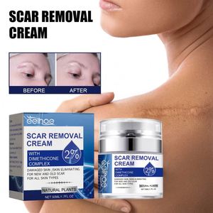 <span class=keywords><strong>Crema</strong></span> Reparadora de Cicatrices EELHOE, Hidratante y Suavizante de la Piel con <span class=keywords><strong>Aloe</strong></span> <span class=keywords><strong>Vera</strong></span>, Desvanece Cicatrices de <span class=keywords><strong>Embarazo</strong></span> y Quirúrgicas, Antiarrugas para el Cuerpo de la Mujer - Product Image 4