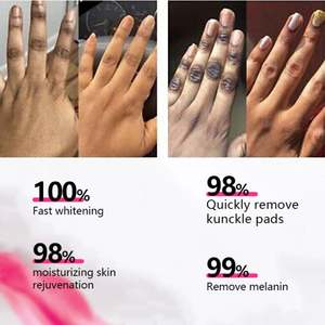 Siero Sbiancante alla Vitamina C per Viso, Rimuove Macchie Scure, <span class=keywords><strong>Melanina</strong></span> e Acido Ascorbico per Articolazioni e Nocche - Product Image 3