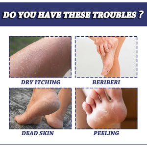 Baume hydratant pour les pieds <span class=keywords><strong>d</strong></span>'<span class=keywords><strong>athlète</strong></span>, soin des pieds gercés, élimination des callosités, soin des ongles, huile <span class=keywords><strong>d</strong></span>'arbre à thé - Product Image 6