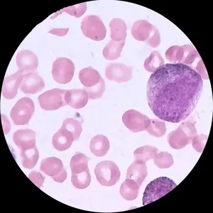Glasmateriaal En Ander Onderwerp 100Pc 'S Menselijke Histologie Dia 'S Set Rode Bloedcellen Microscoopglaasje