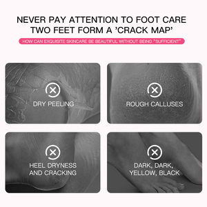 Aiooce <span class=keywords><strong>Masque</strong></span> de Pieds au Lait de Chèvre Collagène <span class=keywords><strong>Hydratant</strong></span> et Peeling, Très Vendu - Product Image 4
