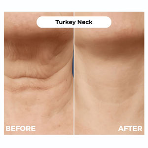 2025 nuevo Kit de cuidado de la piel antienvejecimiento DY péptidos de colágeno de nanosistema <span class=keywords><strong>liofilizado</strong></span> ácido hialurónico líquido antiarrugas - Product Image 3