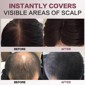 Aliver Med 다크 브라운 여성 루트 터치 업 헤어 파우더 루트 커버 헤어 라인 그림자 파우더 스틱 - Product Image 4