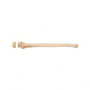 Kyrenmed Massief Schuim Ellepijp Met Olecranon Fractuur Proximaal Links En Rechts Voor Werkplaats Oefenen Boren - Product Image 1