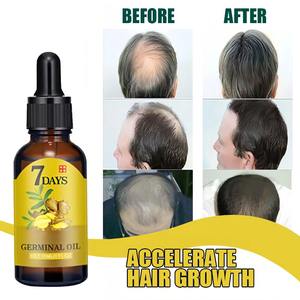 Hight Quality of Hair Repair Blocker Miracle for Ginger <strong>Oil</strong> Hair Growth - Product Image 3