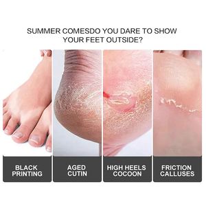 Kit de pédicure vegan de luxe en 4 étapes, parfum de rose, gel pour les <span class=keywords><strong>pieds</strong></span>, éliminateur de <span class=keywords><strong>callosités</strong></span>, masque pour les <span class=keywords><strong>pieds</strong></span>, <span class=keywords><strong>lotion</strong></span> pour le soin de la peau des <span class=keywords><strong>pieds</strong></span> incluse - Product Image 2