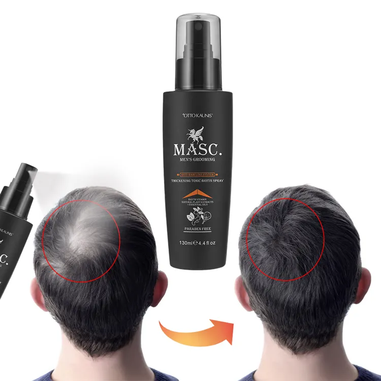 Lo Spray anti-perdita di capelli della biotina di progettazione dell'oem 130ml promuove il trattamento dei capelli più spesso, più forte/ricrescita per gli uomini con estratto di zenzero e olio di menta