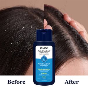 Phổ biến kiểm soát dầu & gàu dầu gội tóc mọc lại điều dưỡng ẩm & cải thiện xoăn cứng làm sạch sâu da đầu OEM dầu gội - Product Image 3