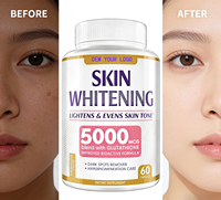 Capsules blanchissantes OEM pour la peau avec gingembre et glutathion 5000mcg/2000mg – Complément de beauté pour éclaircir la peau