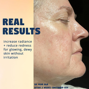 <span class=keywords><strong>ครีม</strong></span>เจลหอยทากขายส่ง ลดรอยแดง รักษาแผลเป็น จุดด่างดำ ลดเลือนริ้วรอย ช่วยให้ผิวชุ่มชื้น - Product Image 2