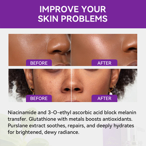 Sérum Visage Anti-Âge et Raffermissant <span class=keywords><strong>DR</strong></span>.ROSEVA à la Niacinamide et <span class=keywords><strong>Double</strong></span> Glutathion pour une Peau Éclatante – Soin de la Peau à Marque Blanche - Product Image 4